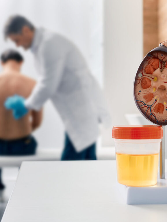 Urology and treatment of kidney disease. Doctor doing kidney exam for male patient with kidney disease, soft focus